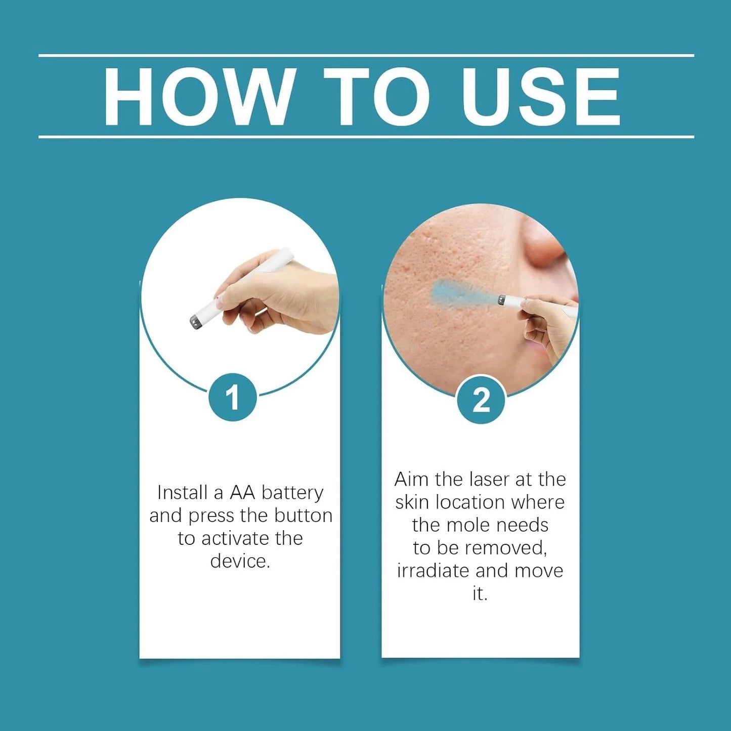 Xorita NON Invasive Mole and Wart Removal pen