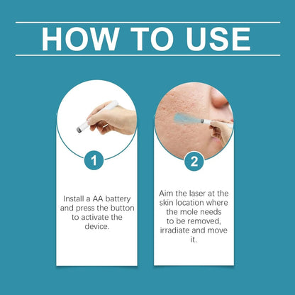 Xorita NON Invasive Mole and Wart Removal pen