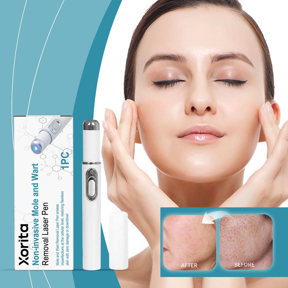 Xorita NON Invasive Mole and Wart Removal pen